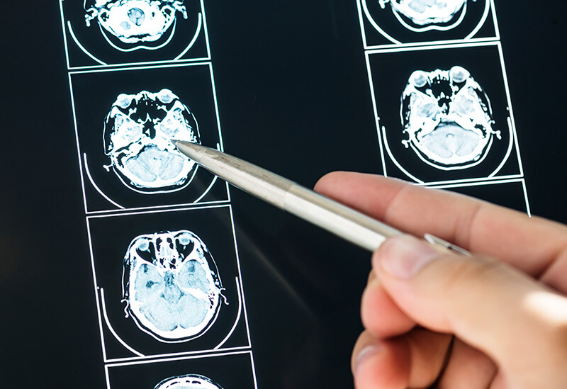 what is a castastrophic injury