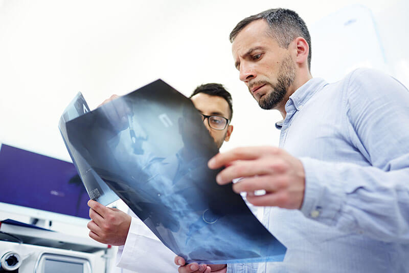 severe prognosis of spinal cord injury